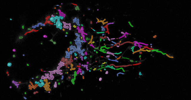 U2OS cell, human osteosarcoma Mitochondria labelled with MitoView green; analysis result from THUNDER and Aivia.