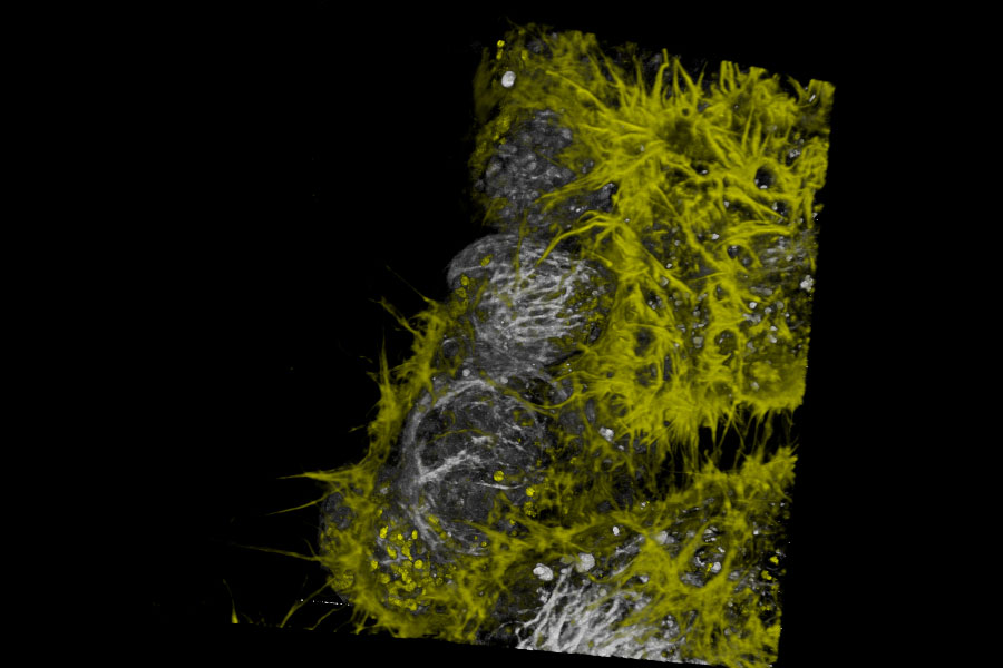 Live NE-115 cells expressing mNeonGreen-LifeAct are stained with MitoTracker Green, NucRed and SiR Tubulin.
