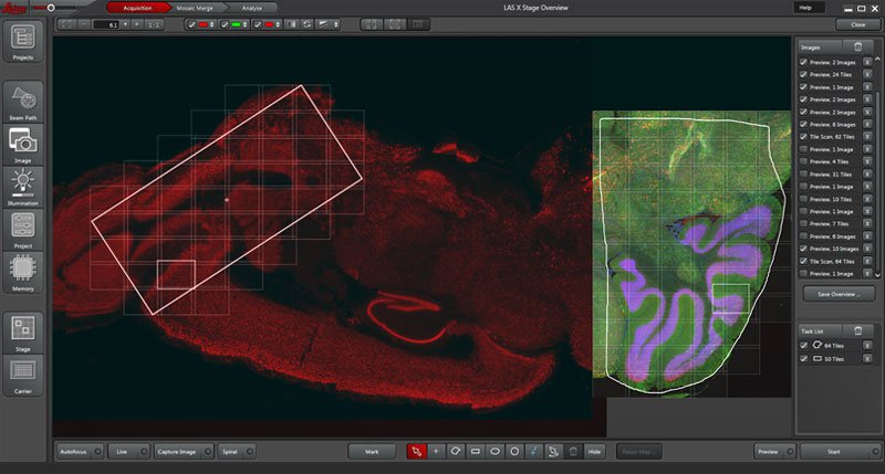 bioscoop Afleiding slecht humeur LAS X Life Science Microscope Software | Products | Leica Microsystems bioscoop Afleiding slecht humeur LAS X Life Science Microscope Software | Products | Leica Microsystems