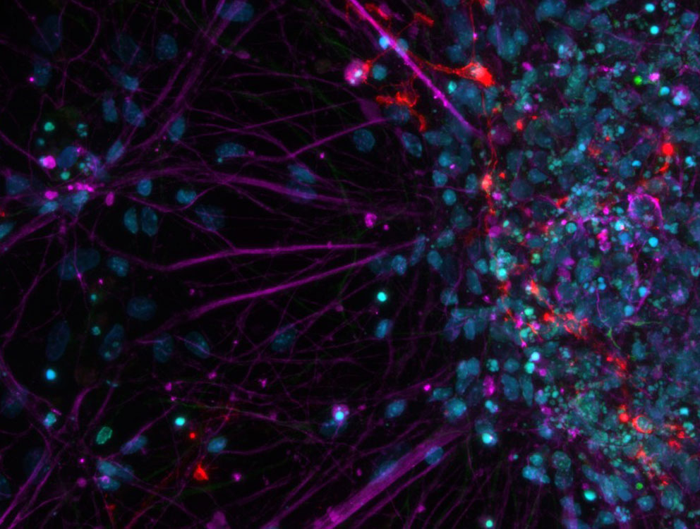 Primary cell culture from rat; Cy5 (magenta): Beta-III tubulin; Rhod (red): NG2 protein, GFP (green): Nestin protein; and DAPI (blue): nuclei.