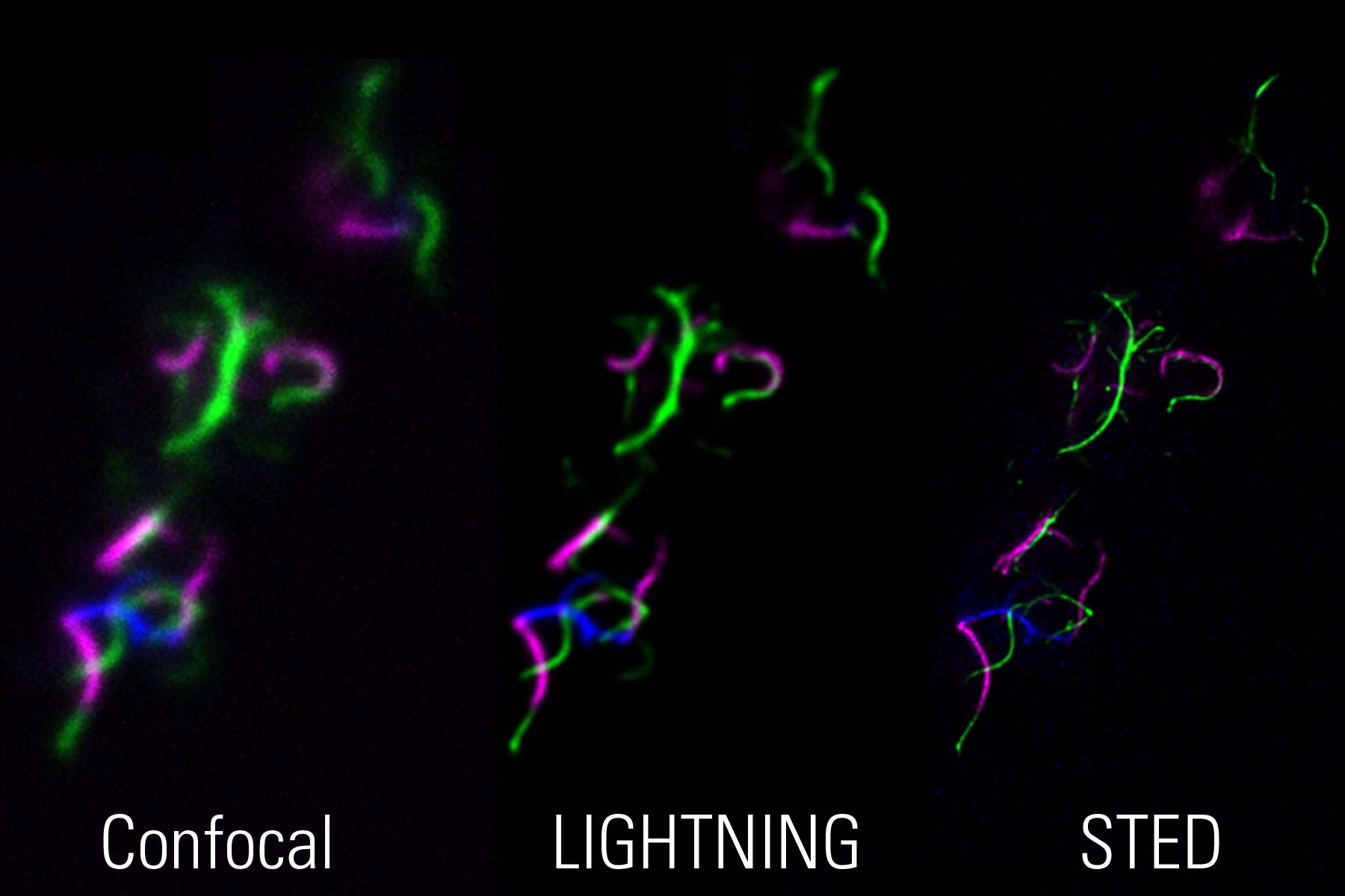 STED の微生物学アプリケーション: 共焦点、LIGHTNING、STED イメージングによって可視化されたバクテリア鞭毛の三重染色画像。補完的手法を用いることで、試料の調査と検証を可能にする。 試料提供: Marc Erhardt 博士、Humboldt-Universität、ドイツ・ベルリン。