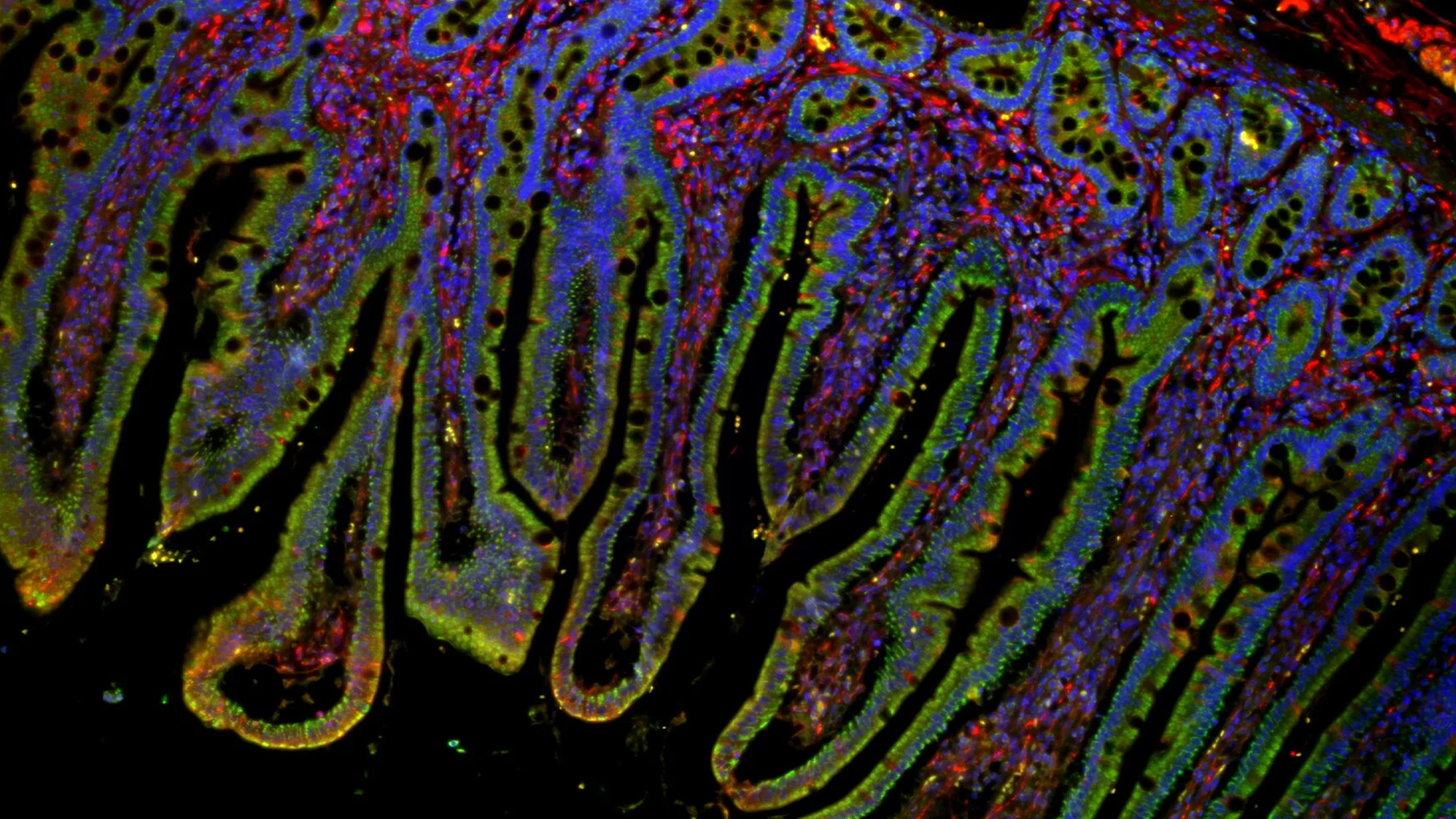  Mica widefield image of intestine tissue specimen at 10x magnification. Nuclei are labeled blue, mitochondria green, and detyrosinated tubulin red. 
