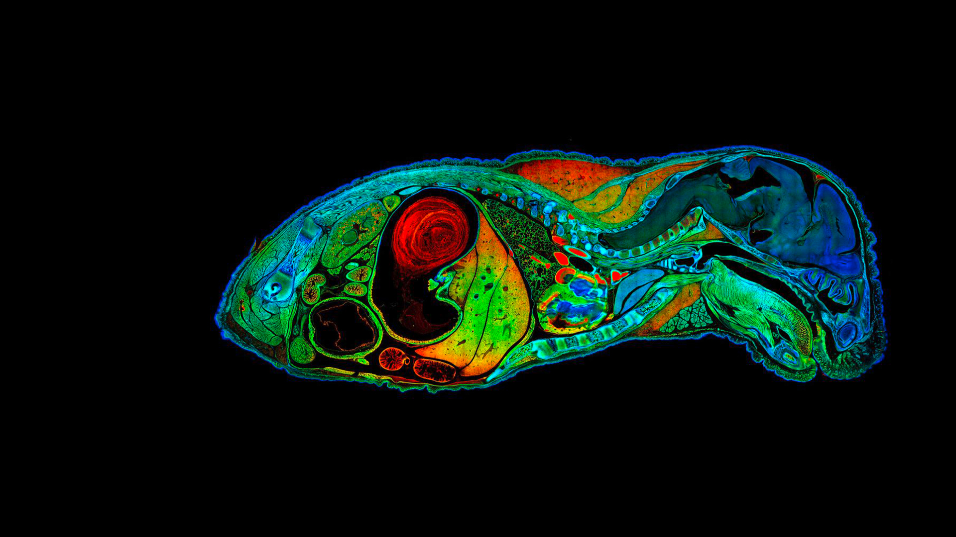 Microscopia confocal – Wikipédia, a enciclopédia livre