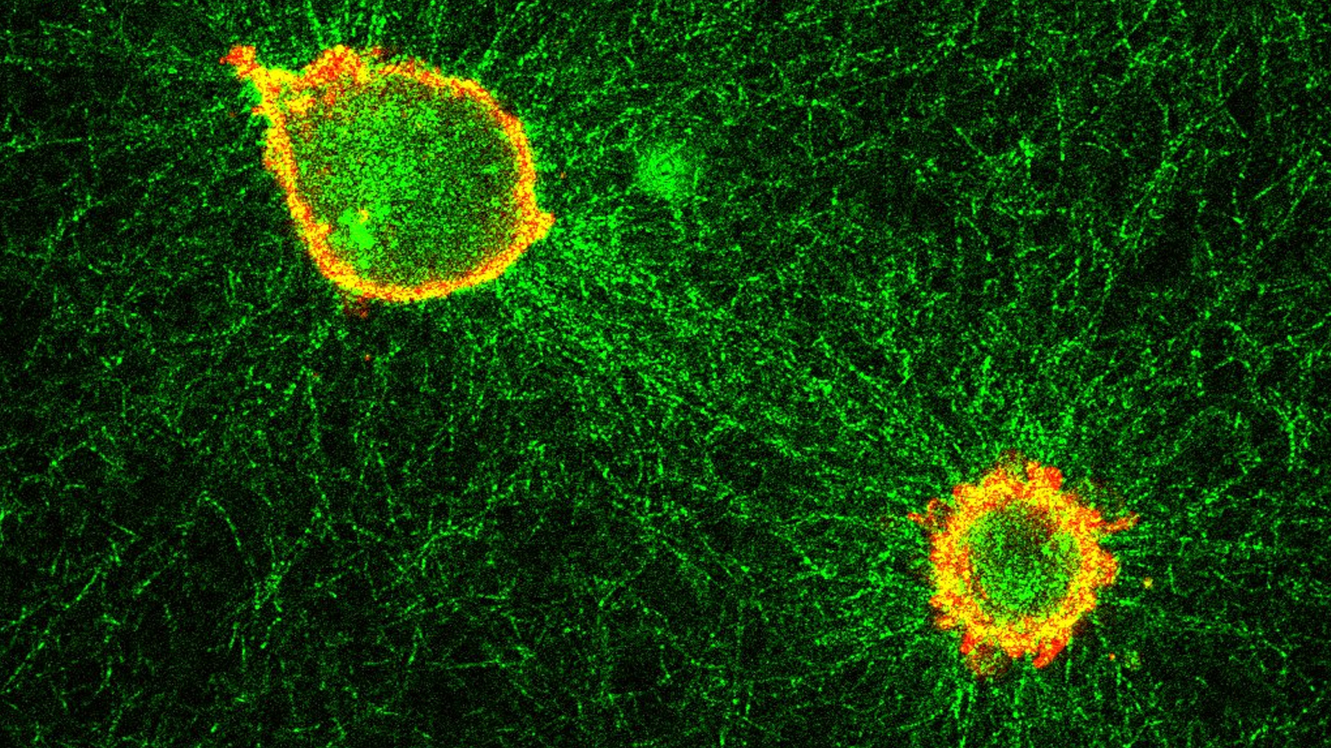 Microscopia confocal – Wikipédia, a enciclopédia livre