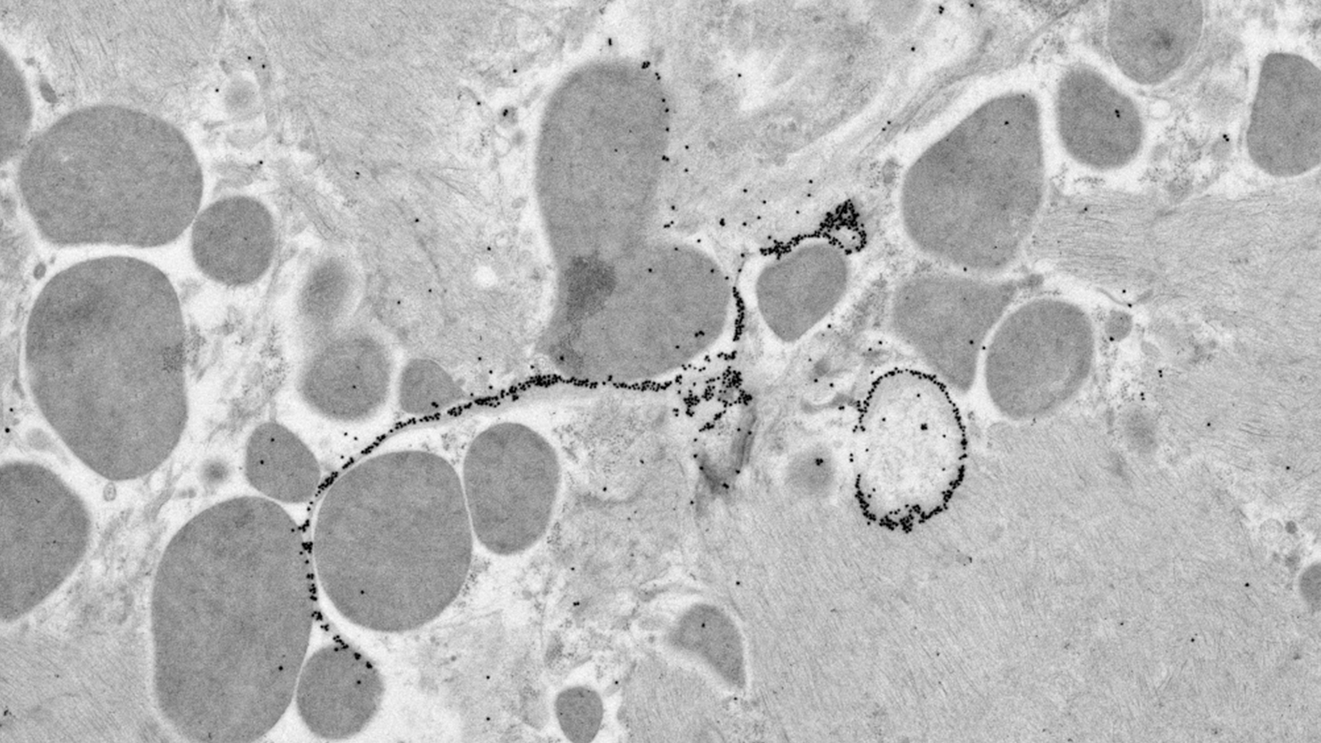 Introduction to Ultramicrotomy – Mouse heart. Courtesy of Riet De Rycke, University of Gent. 