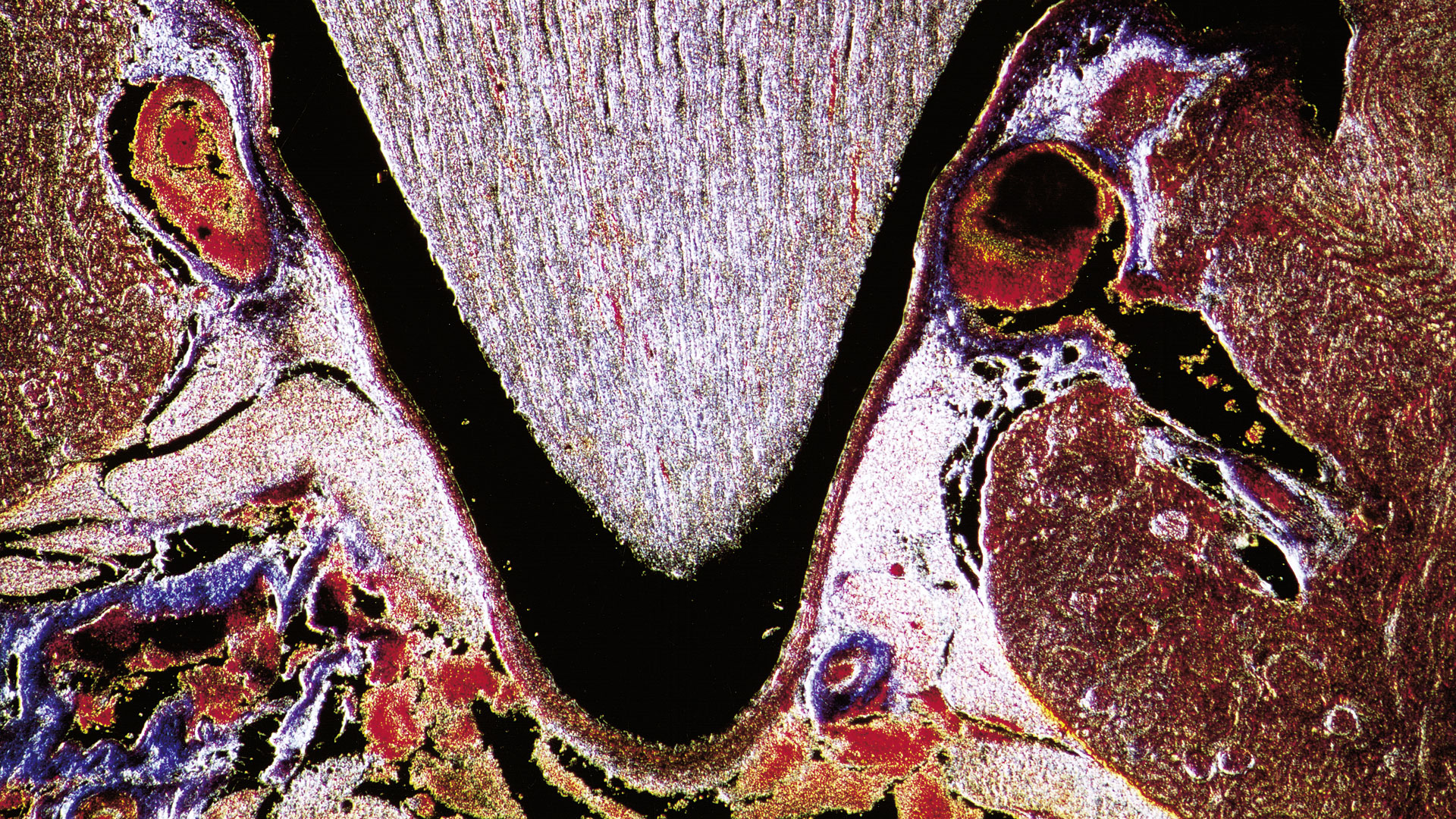 thumbnail image 2 of 32mm Microscope Annuli Set - 8 Annuli + Darkfield Center Stop, Made In USA 2 of 4
