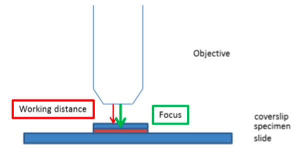 Free working distance. The FWD is the distance between the front lens and the covership surface facing the objective