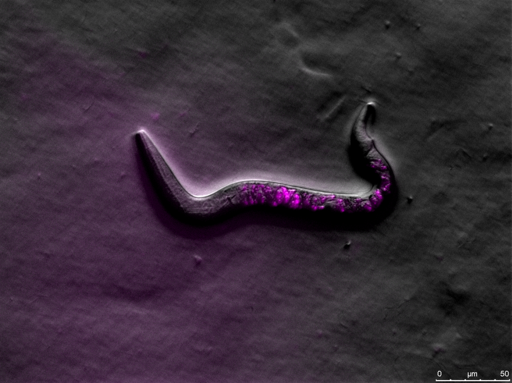 C. elegans. Rottermann contrast and fluorescence (mCherry). Image captured with a Leica M205 FA motorized fluorescence high performance stereo microscope. 