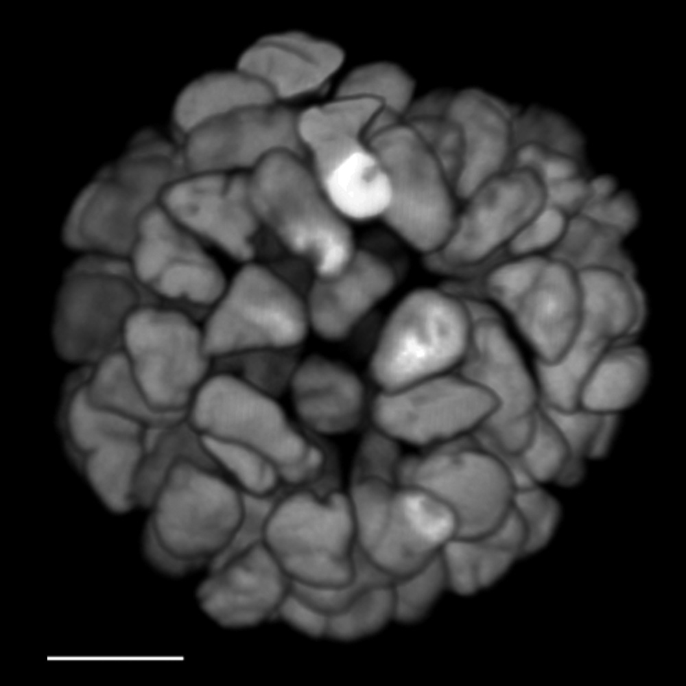 FLIM comparison slider "Before": FLIM on a live 3D patient-derived cancer organoid. Monitoring cancer-derived increase of signal transduction activity in live organoids with an ERK FRET-FLIM biosensor.