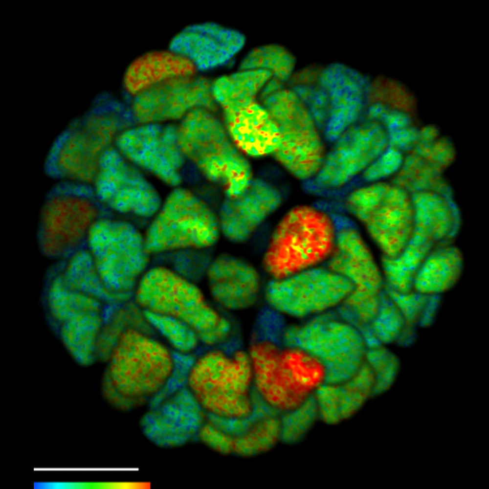 FLIM comparison slider "After": FLIM on a live 3D patient-derived cancer organoid. Monitoring cancer-derived increase of signal transduction activity in live organoids with an ERK FRET-FLIM biosensor.