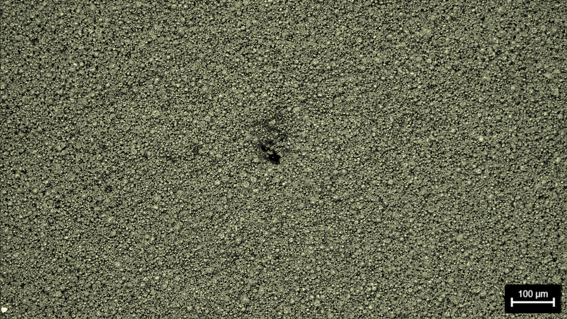 Battery electrode showing a hole defect. Image acquired with darkfield illumination and a Leica compound microscope.