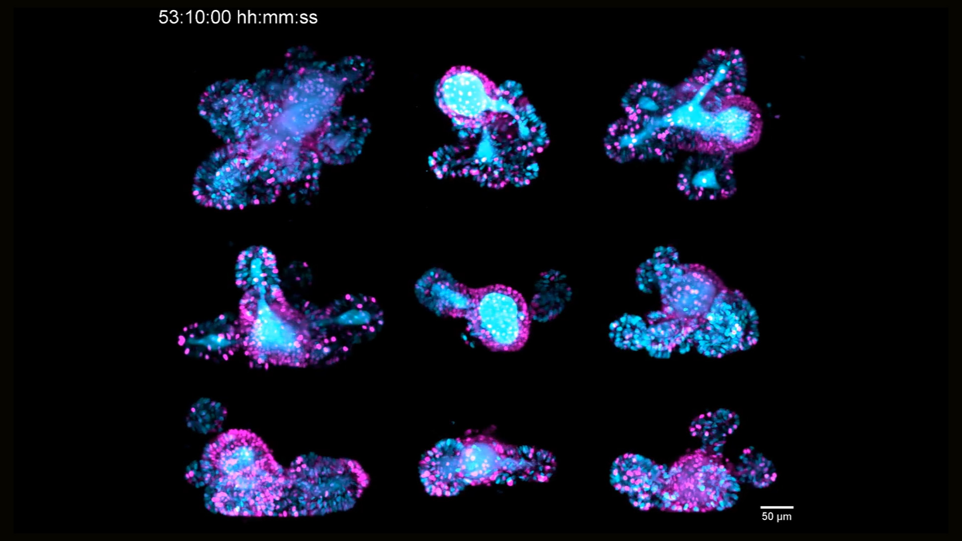 67-hour, multi-position time-lapse of mouse intestinal organoids expressing the cell cycle reporter FUCCI2 (hGem-mVenus and hCdt1-mCherry), acquired using Viventis Deep. 
