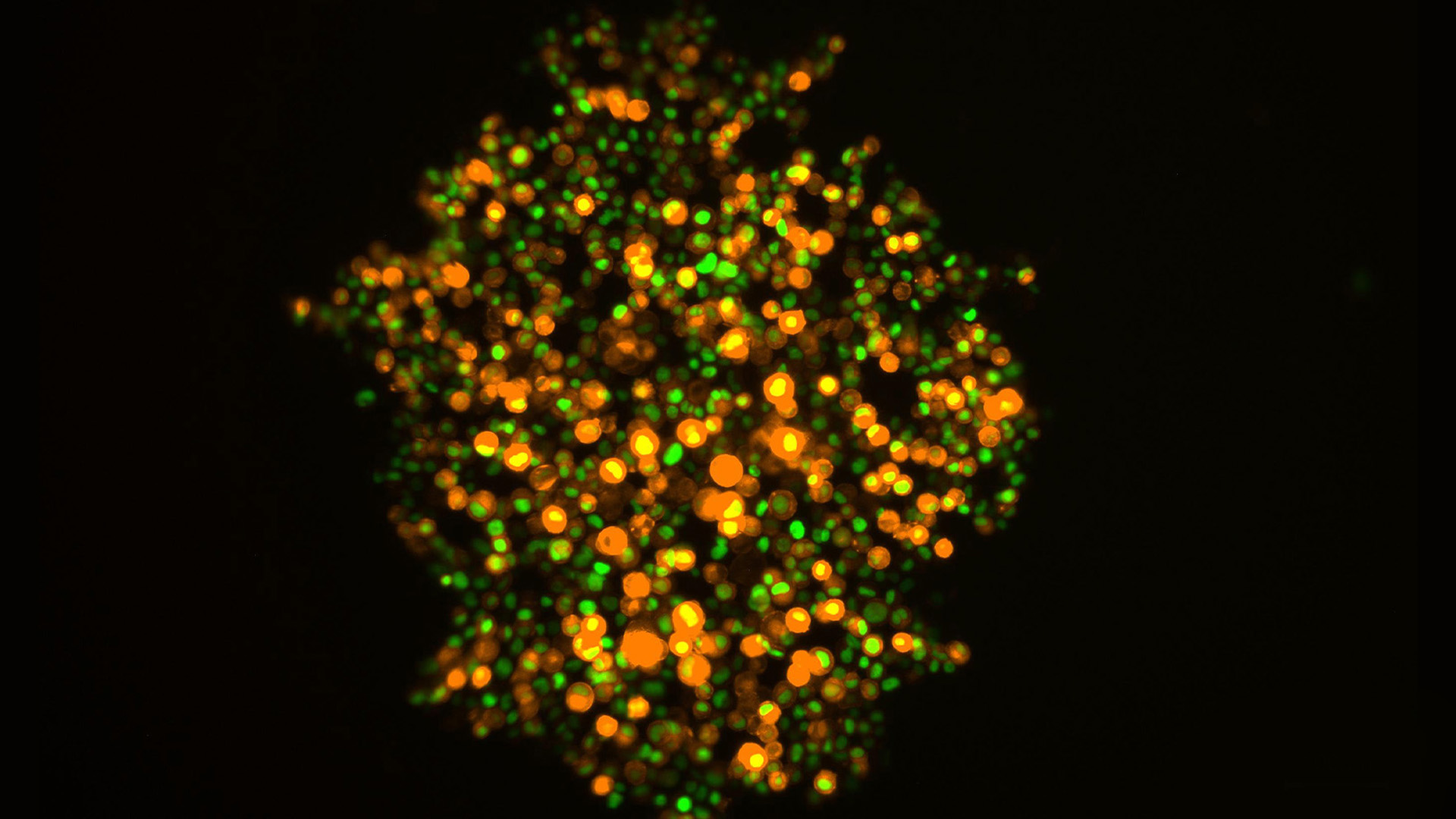 T47D breast cancer cell spheroid Formation (Day 0). Fluorescent labeling of nuclei (Histone2B-eGFP) and F-actin (LifeAct-mCherry) reveals cytoskeletal organization and aggregation during ECM development and spheroid formation. Image acquired using a Mateo FL Digital Fluorescence Microscope; scale bar 100 μm.