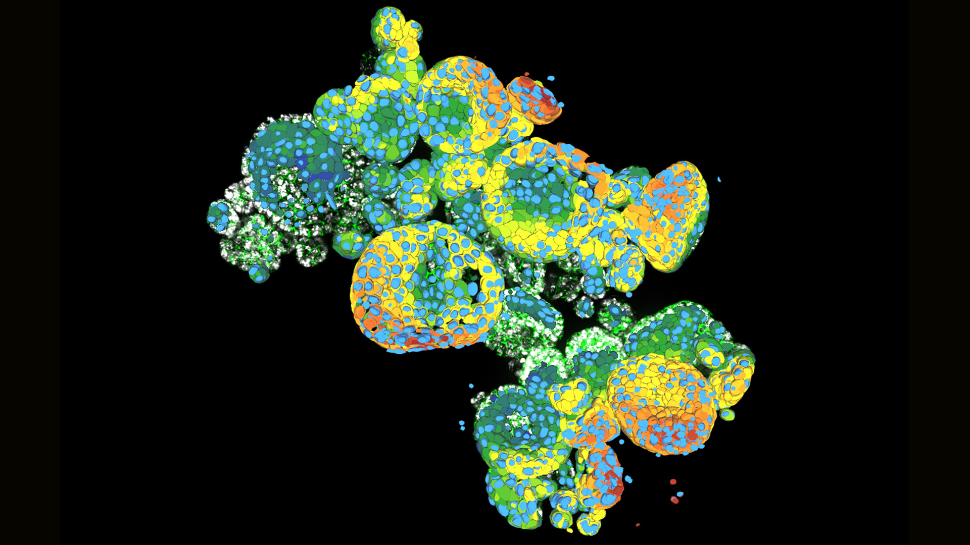 Organoid cluster labelled for nuclei (DAPI, blue) and plasma membrane (GFP, green). Thickness 100 μm. 469 Z planes were acquired using THUNDER Imager Cell (63x objective) and analyzed with Aivia. Courtesy of M.Sc. Dana Krauß, Medical University of Vienna, Austria.