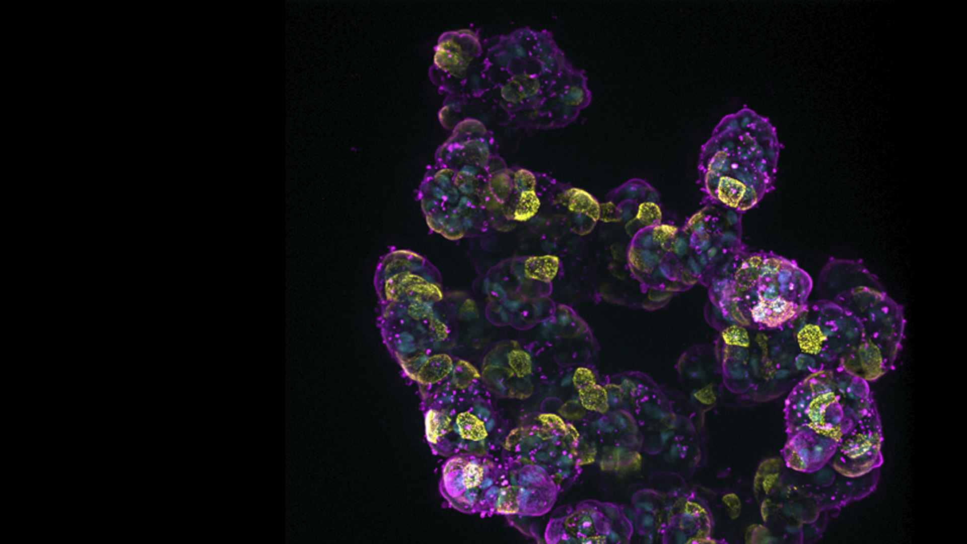 14: 7-day old 3D cell culture of MDCK cells stably transfected with; Mx1-GFP (green), SPY555-Actin (yellow) and WGA-AlexaTM 647 (magenta), and imaged using a THUNDER Imager Cell Spinning Disk. Shown are both the spinning disk image (left) and the same image after THUNDER Computational Clearing was applied (right); scale bar 50 μm.