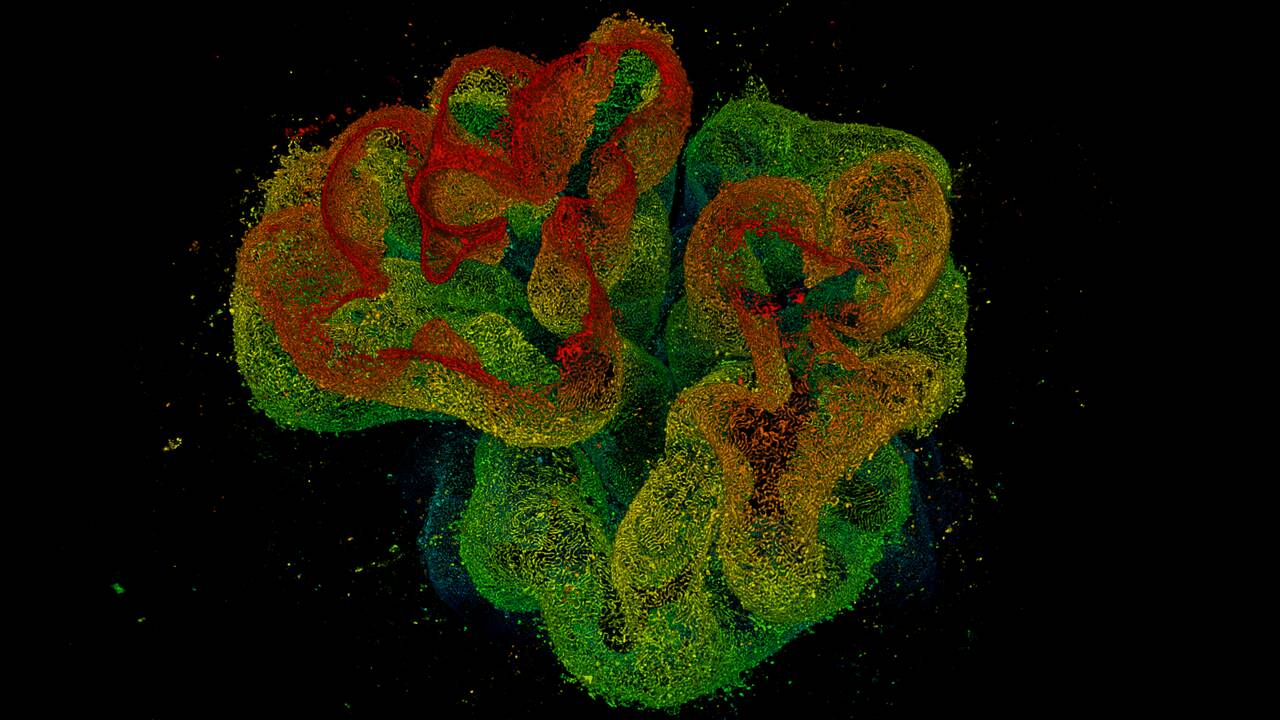 3D STED imaging of an optically cleared rat kidney section. Nephrin immunolabelled with STAR 635P. Excitation and STED performed with 640 nm and 775 nm, respectively. Image dimensions x,y,z, 83 µm x 83 µm x 40 µm. Volume is color coded for depth. Image courtesy: David Unnersjö Jess, KTH, Stockholm, Sweden.