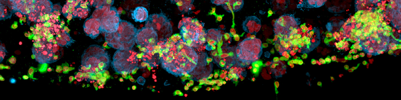 Co-culture of CAR-T cells and breast cancer organoids. CAR-T cells labeled by CD3 (green). Breast cancer organoids labeled by membrane marker B7H3 (blue). DNA labeled by SiR-DNA (red). Image acquired using STELLARIS. Image courtesy of Dr Ravian van Ineveld and Prof. Dr Anne Rios, DREAM3D Lab.