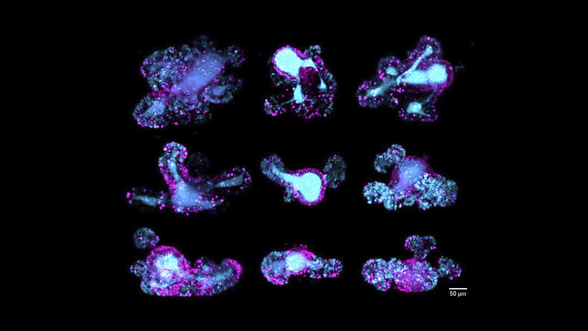67-hour multi-position time-lapse of multiple mouse intestinal organoids in parallel, to follow cell cycle dynamics; scale bar 50 μm. Acquired using Viventis Deep. Maximum intensity projection along the z-axis. Courtesy of Franziska Moos, Liberali group, FMI, Basel, Switzerland.