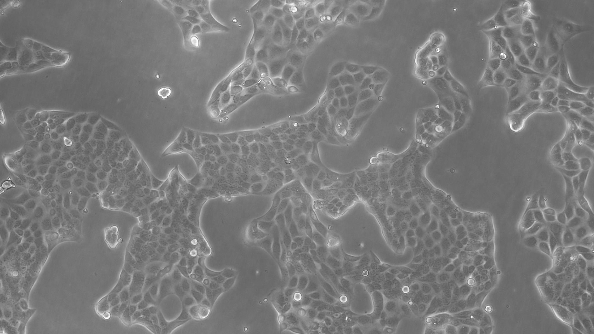 Cultivo das células endoteliais de rato Lewis. Na figura A possuímos