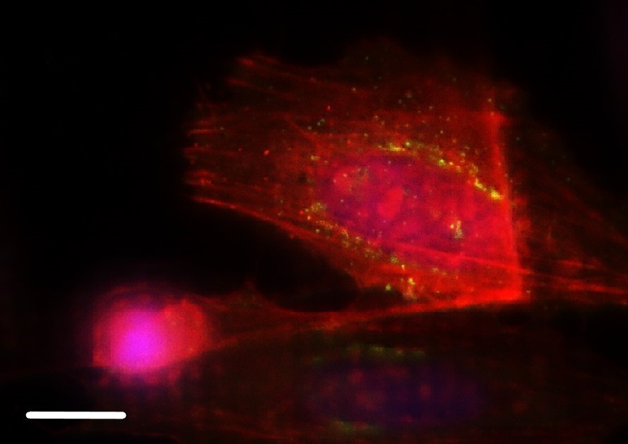 HeLa cells without THUNDER Imager