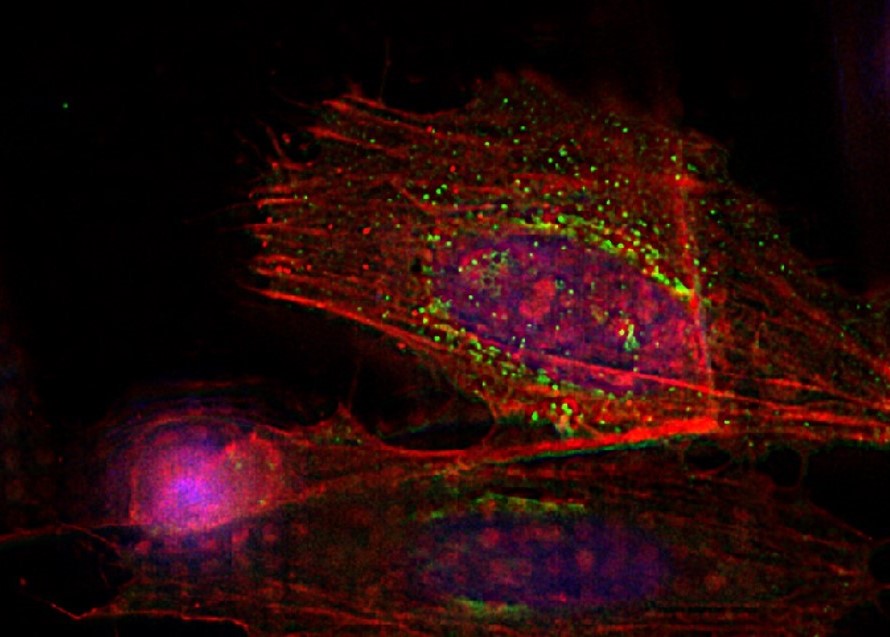 HeLa cells with THUNDER Imager