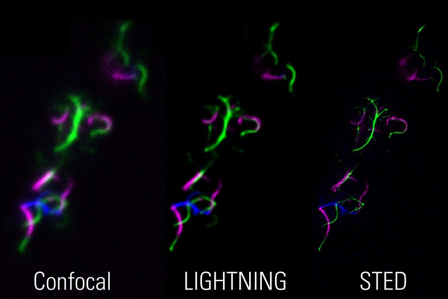 Images of bacterial flagella: Correlative 3-color confocal-LIGHTNING-STED imaging allows the simultaneous use of the complementary approaches for the investigation and validation of samples. Sample courtesy of Marc Erhardt, Humboldt-Universität, Berlin, Germany.