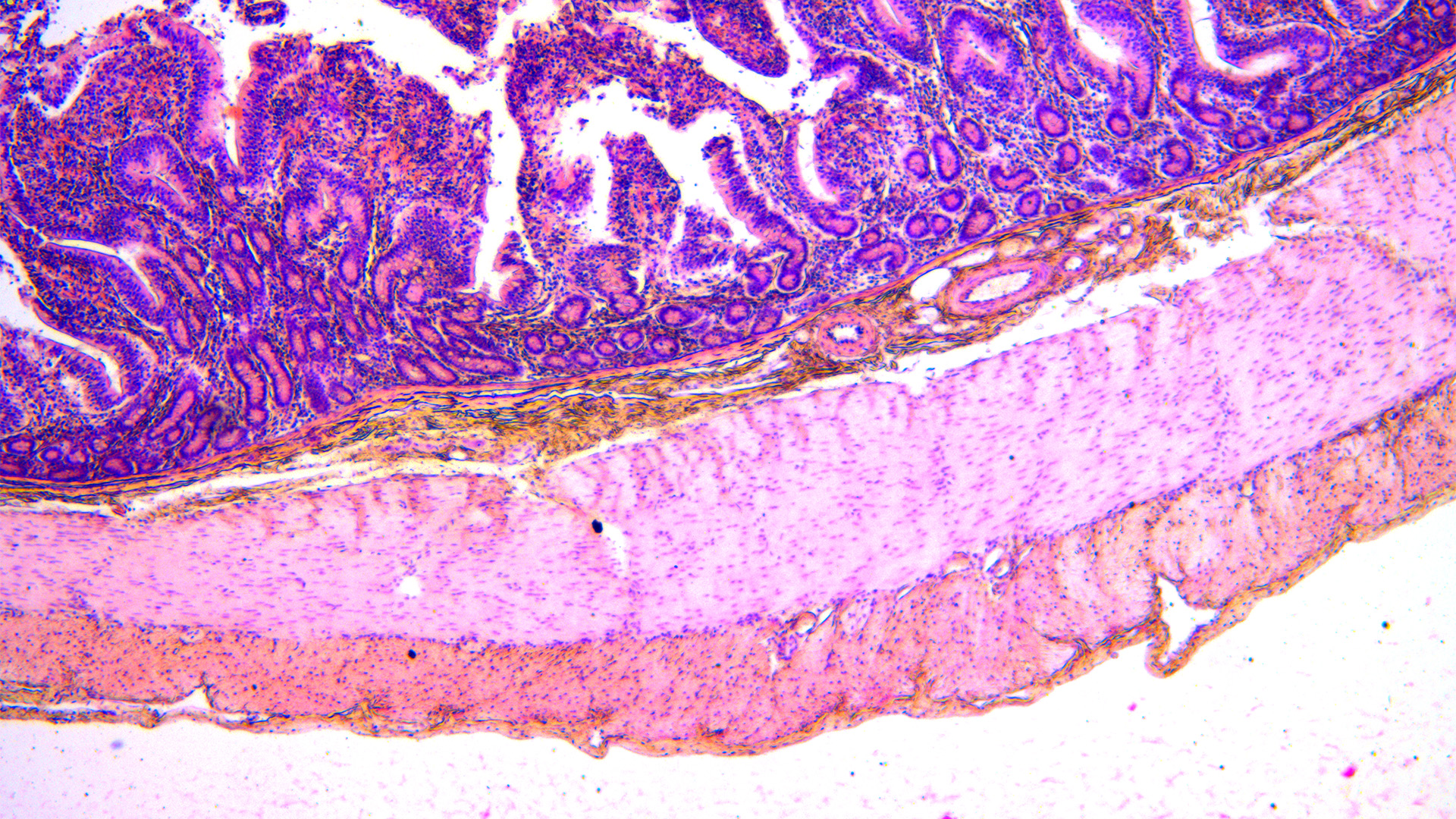 Image of a H&E-stained duodenum showing the boundary between the submucosal and mucosal regions, making it easy to distinguish the different cell types.