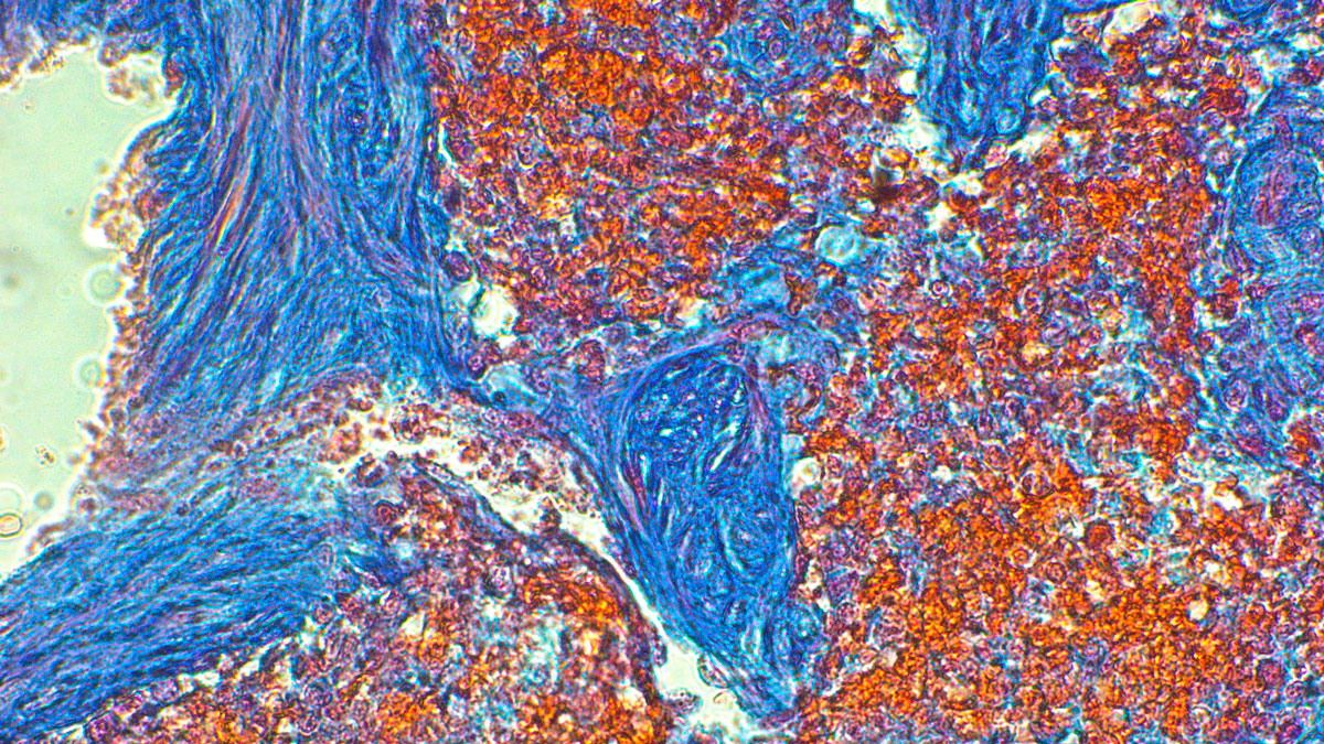 Clinical laboratory and pathology