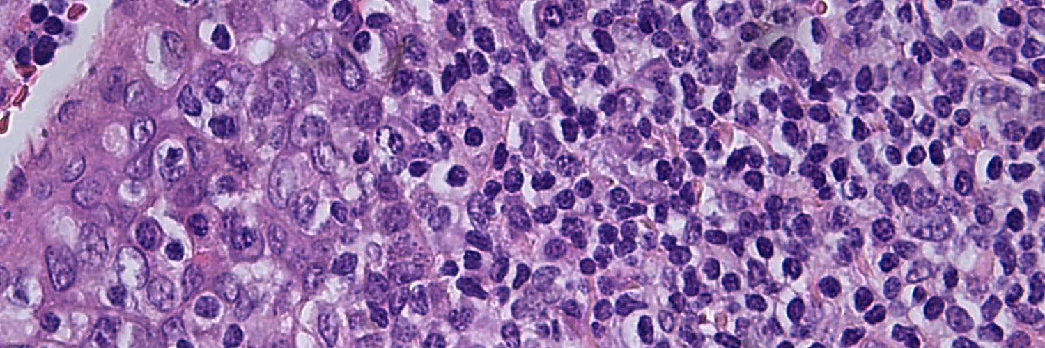 H&E stained tissue specimen H&E stained tissue specimen