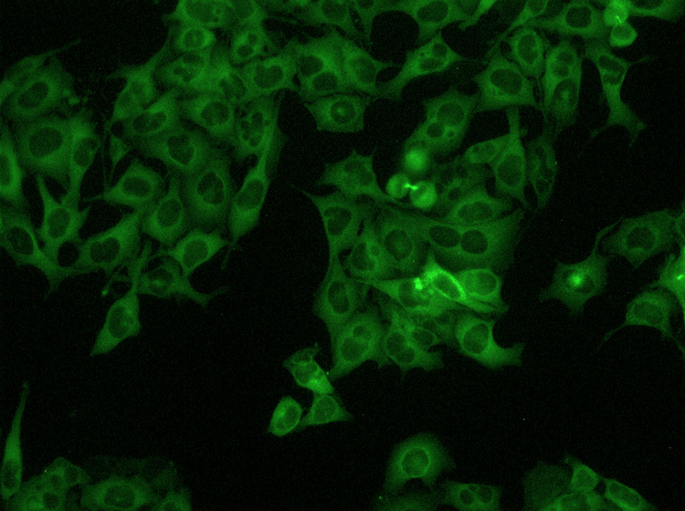 Células HeLa vistas con fluorescencia 20x
