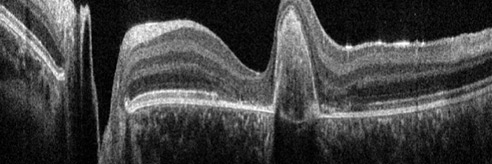 眼科OCT成像系统显微镜解决方案