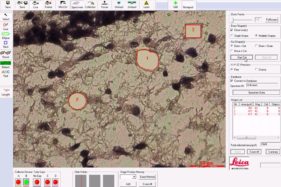 Software para microdisección láser Software para microdisección láser