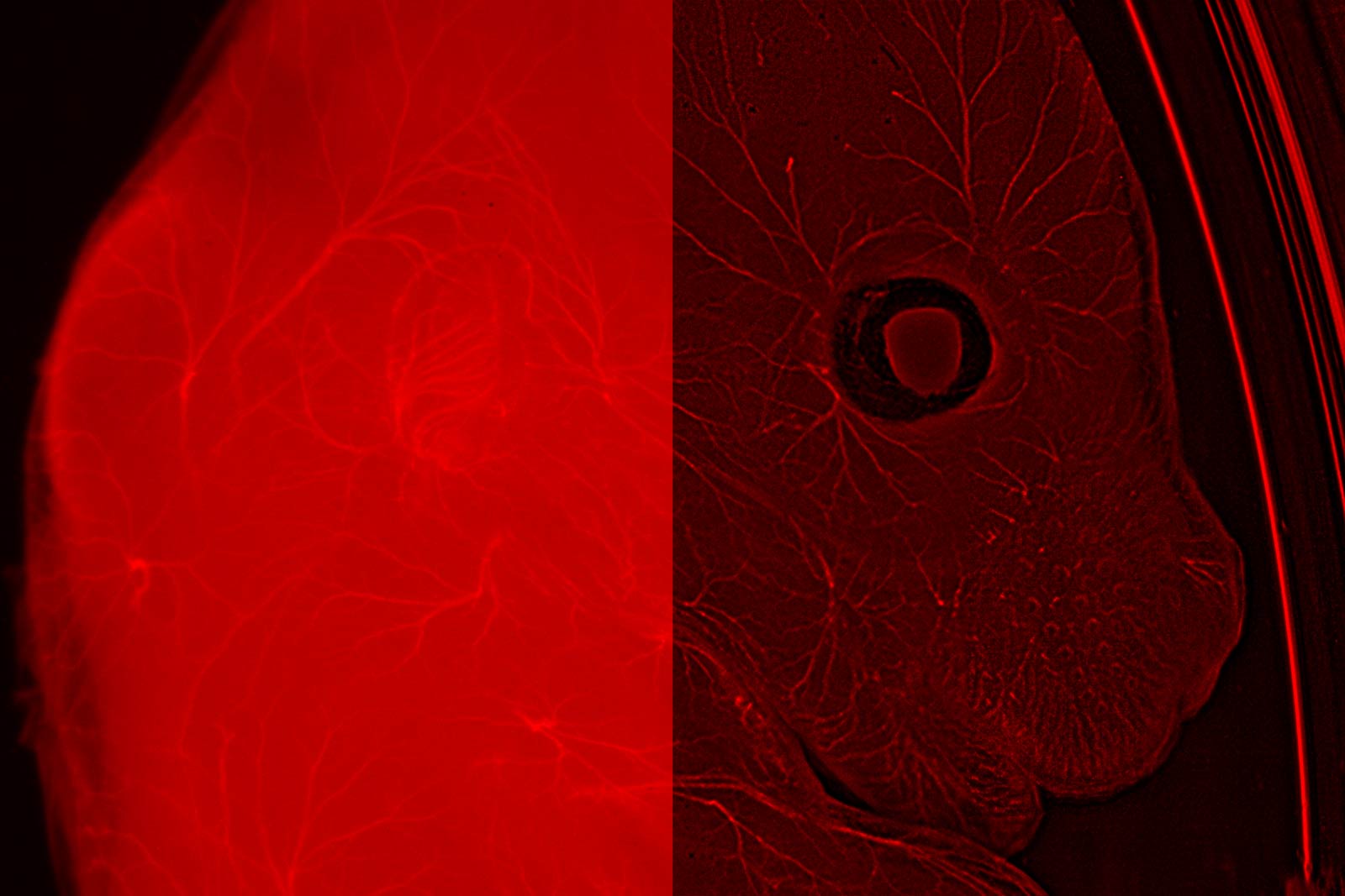 In this E12-13 muose (wt sample), neurafilaments are stained in red to assess neuronal outgrowth. The mouse was cleared with the ScaleS reagent. Sample courtesy Yves Lutz, Centre d'imagerie, IGBMC, France.