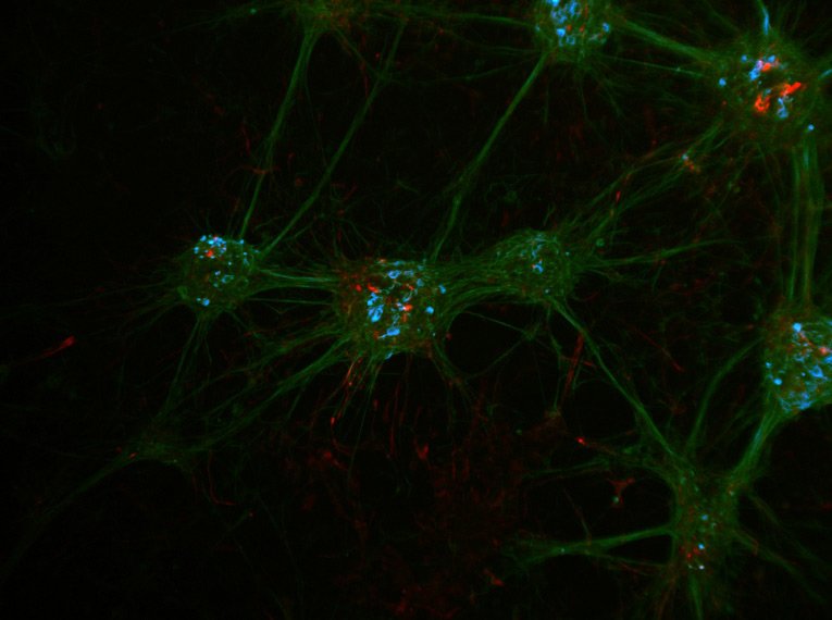 Cultura de neurônios marcada com DAPI, Tubulina Beta III - Cy2, Nestina - Cy3 (LMS Bioanalytik GmbH,  Magdeburg,  Alemanha). Azul indica núcleo das células, neurônios verdes expressando Tubulina Beta III e células tronco expressando nestina em vermelho. Imagem adquirida em um estereomicroscópio Leica M205 FCA, platina LMT260, câmera DFC3000 G e Fluocombi III em 400x de aumento.