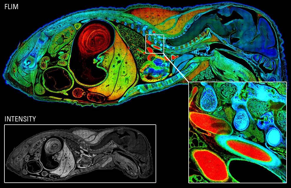 Adquisición sencilla de muestras complejas. Imagen mosaico de alta resolución de un embrión de ratón consistente en 722 imágenes, con un total de 190 megapíxeles. Datos FLIM con cuatro tiempos de vida de fluorescentes característicos, codificados por color. Obtención: 1:23 h. Análisis: 1:00 h
