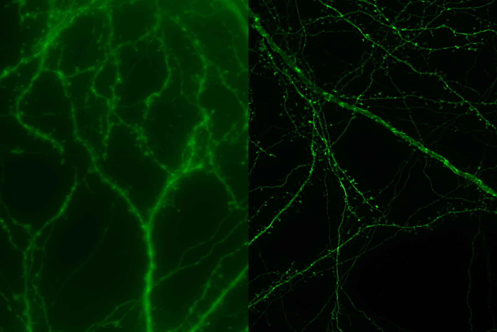 Mouse cortical neurons - THUNDER Imager