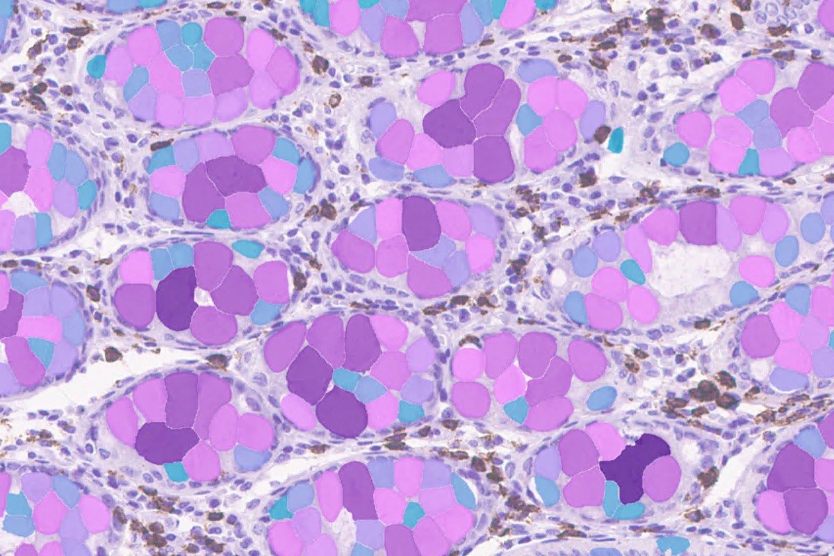 Aivia - Segment by Example for accurate segmentation