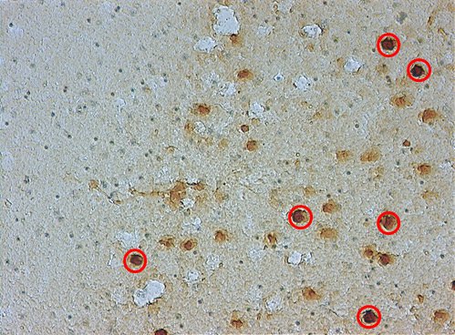 ROI definition in murine brain cryosection. DAB staining. ROI definition in murine brain cryosection. DAB staining.