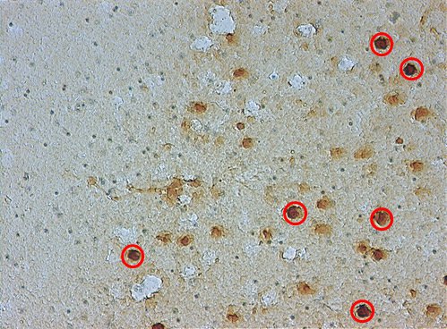 ROI definition in murine brain cryosection. DAB staining. 