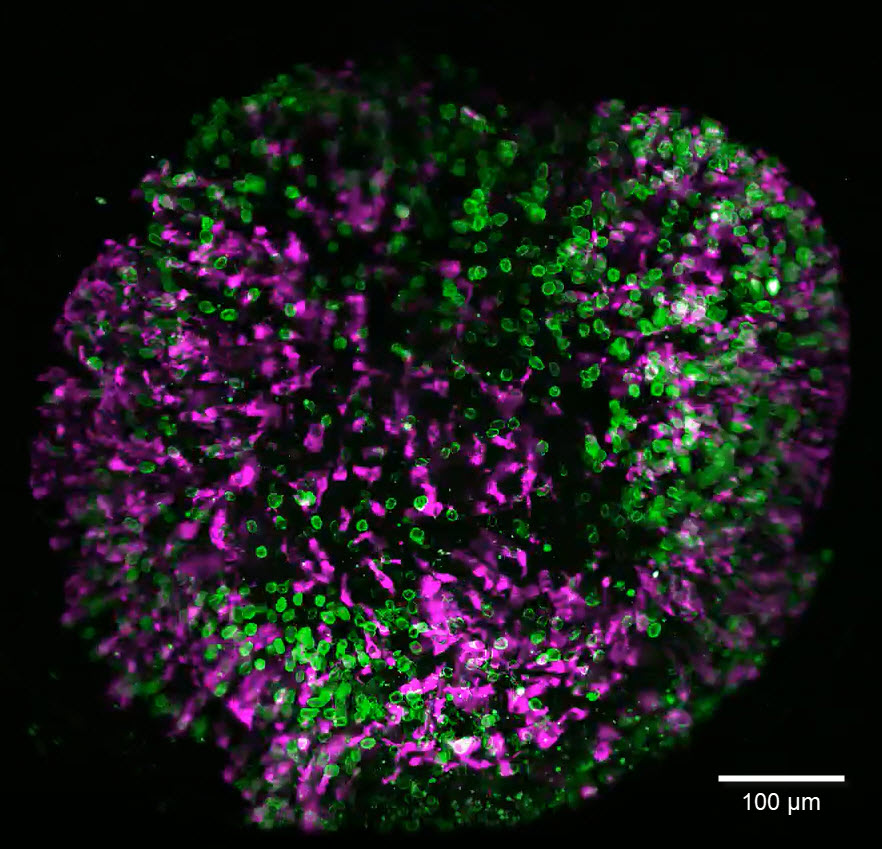 Brain organoid labeled with lamin (green) and tubulin (magenta), acquired using Viventis Deep. Courtesy of Akanksha Jain, Treutlein Lab ETH-DBSSE Basel (Switzerland).