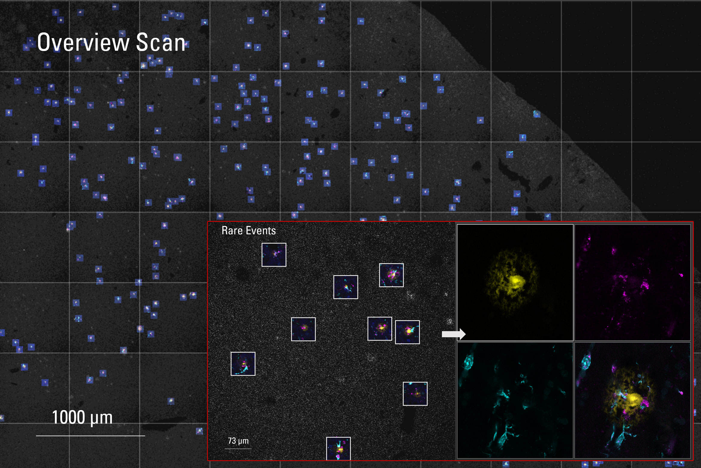 [Translate to chinese:] Images of 50-µm-thick human-brain sections (Alzheimer disease donors) 