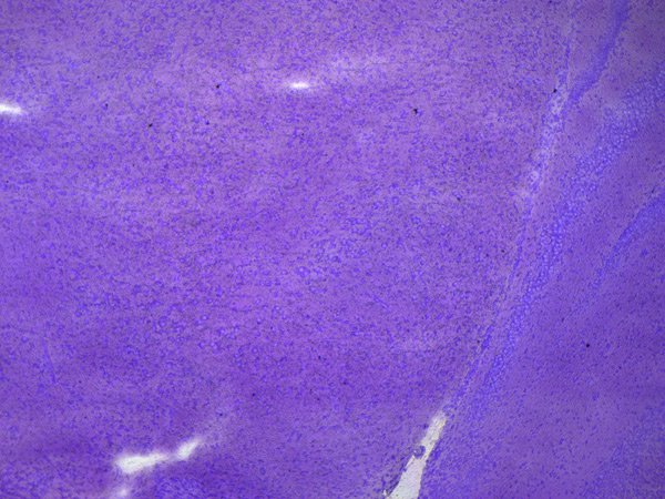Murine midbrain cryo-section with substantia nigra. Cresyl violet staining.