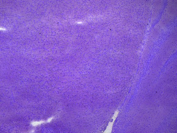 Murine midbrain cryo-section with substantia nigra. Cresyl violet staining. Murine midbrain cryo-section with substantia nigra. Cresyl violet staining.