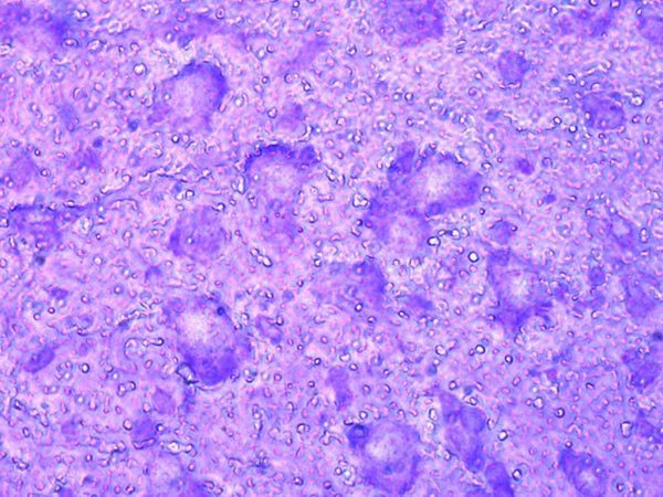 Mouse brain cryo-section before laser microdissection. Cresyl violet staining.