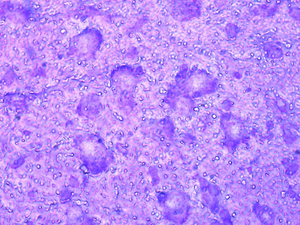 Mouse brain cryo-section before laser microdissection. Cresyl violet staining. Mouse brain cryo-section before laser microdissection. Cresyl violet staining.