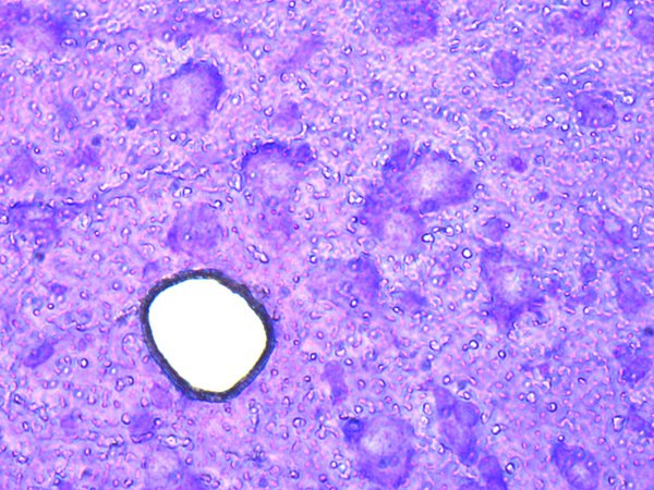 Mouse brain cryo-section after laser microdissection. Cresyl violet staining. Mouse brain cryo-section after laser microdissection. Cresyl violet staining.