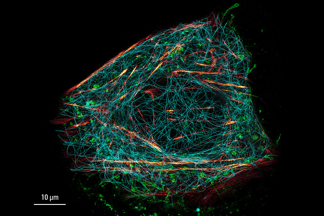 Live cell TauSTED on U2OS cells - sted