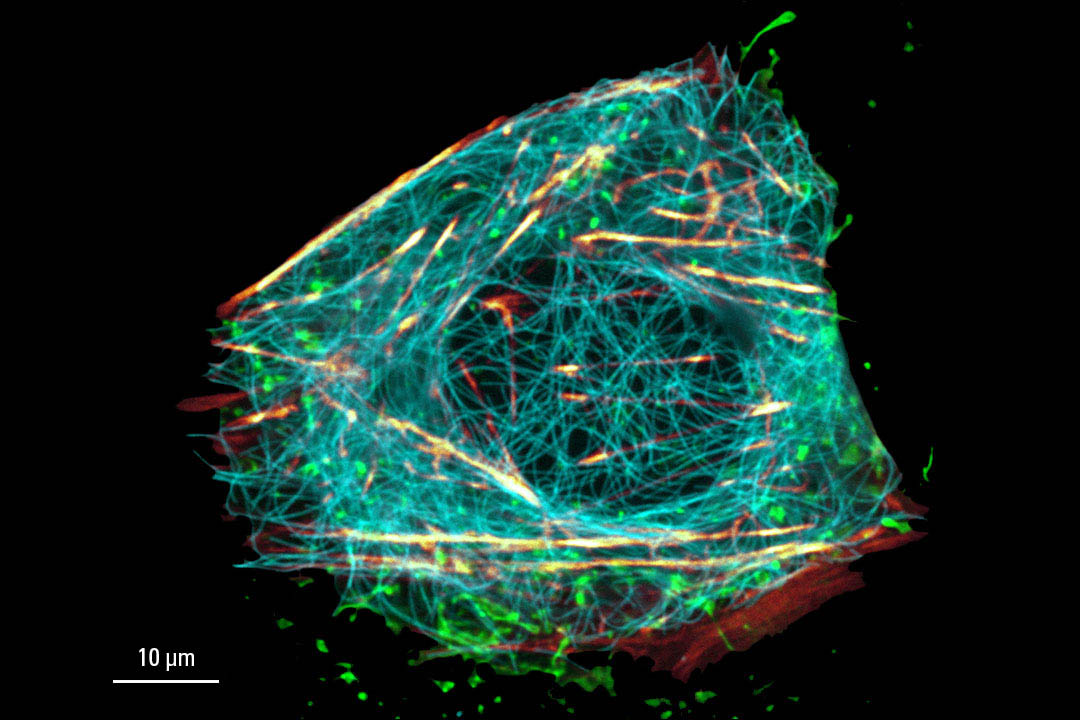 Confocal Live cell TauSTED on U2OS cells - confocal