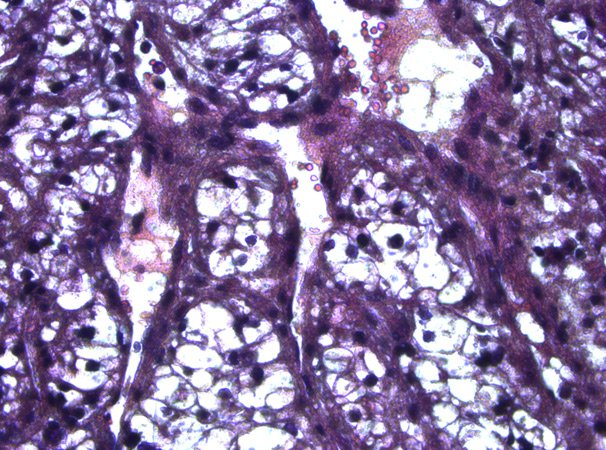 Human kidney tissue before laser microdissection. H & E staining.