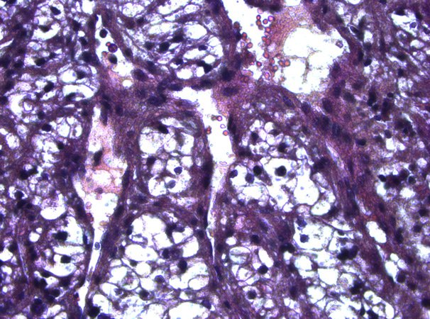 Human kidney tissue before laser microdissection. H & E staining. Human kidney tissue before laser microdissection. H & E staining.